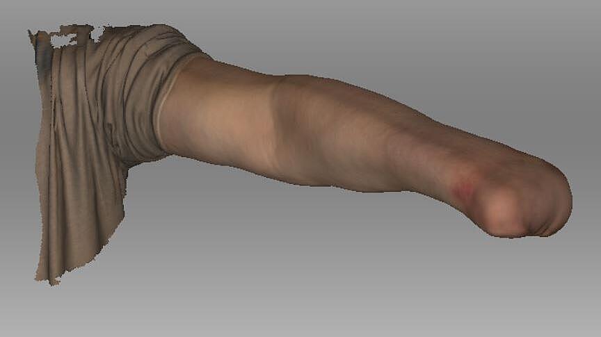 Texturmaterial 3D-Scan eines Armstumpfes Texturmaterial des Scans in 3D eines Armstumpfs nach einer Amputation