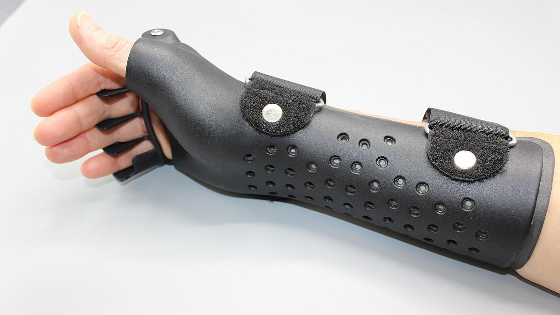 Ulnardeviationsorthesen aus dem 3D-Drucker schwarze Ulnardeviationsorthesen aus dem 3D-Drucker