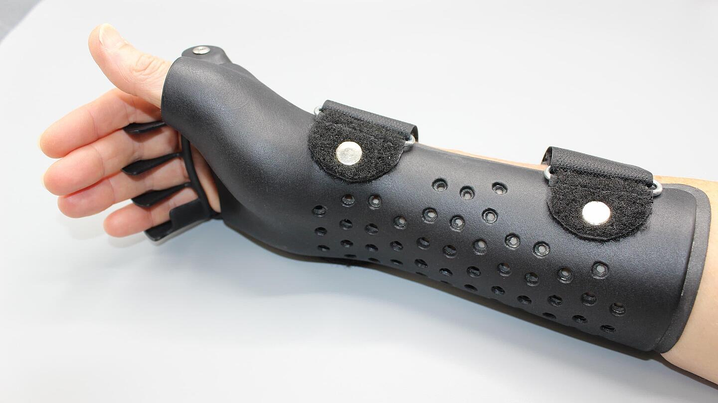 Ulnardeviationsorthesen aus dem 3D-Drucker schwarze Ulnardeviationsorthesen aus dem 3D-Drucker