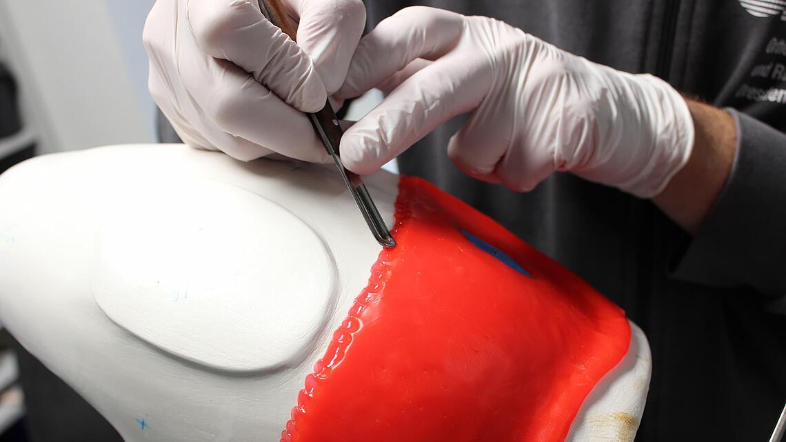 Modellierung eines Oberschenkelschaftes aus Silikon Modellierung eines Oberschenkelschaftes aus Silikon mit Spatel