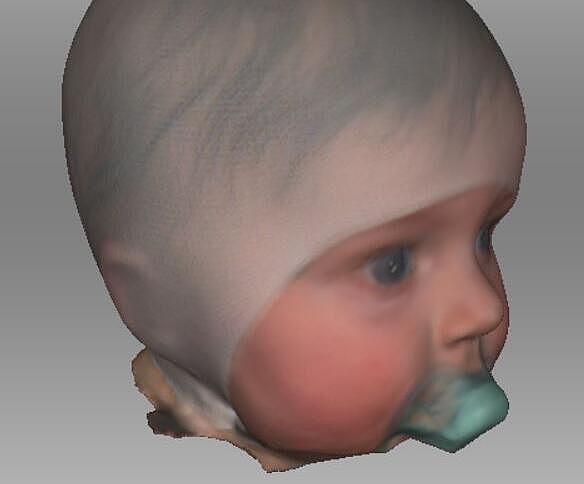 3D-Scan eines Säuglingkopfs Kopf-Scans in 3D eines Säuglings
