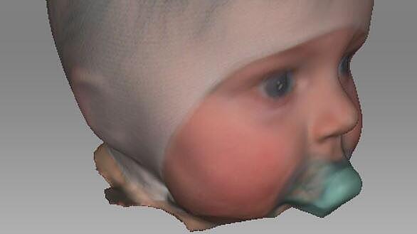 3D-Scan eines Säuglingkopfs Kopf-Scans in 3D eines Säuglings