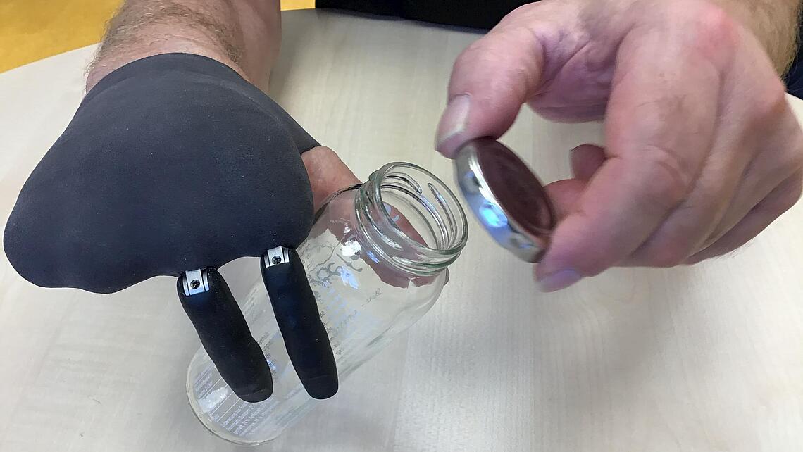 Teilhandprothese mit Flasche Teilhandprothese, die eine Flasche zum Öffnen hält
