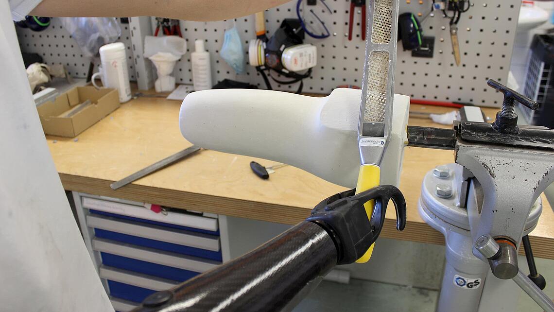 Unterarmprothese mit Greifer Unterarmprothese mit Greifer, der Gips feilt