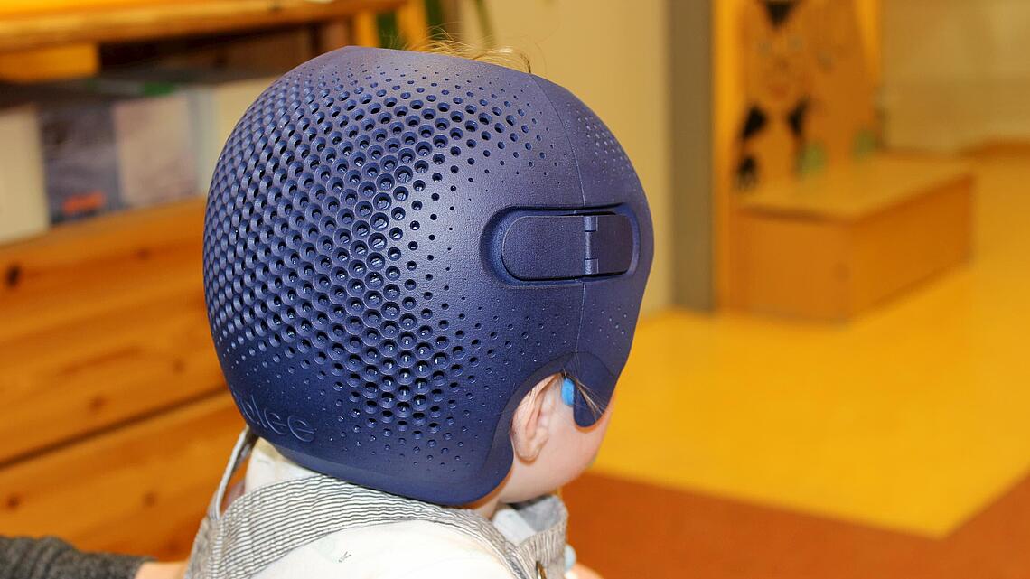 Säugling von hinten mit Kopfkorrektur-Helm von Talee aus 3D-Drucker Säugling von hinten mit Helm aus dem 3D-Drucker von Talee zur Kopfkorrektur