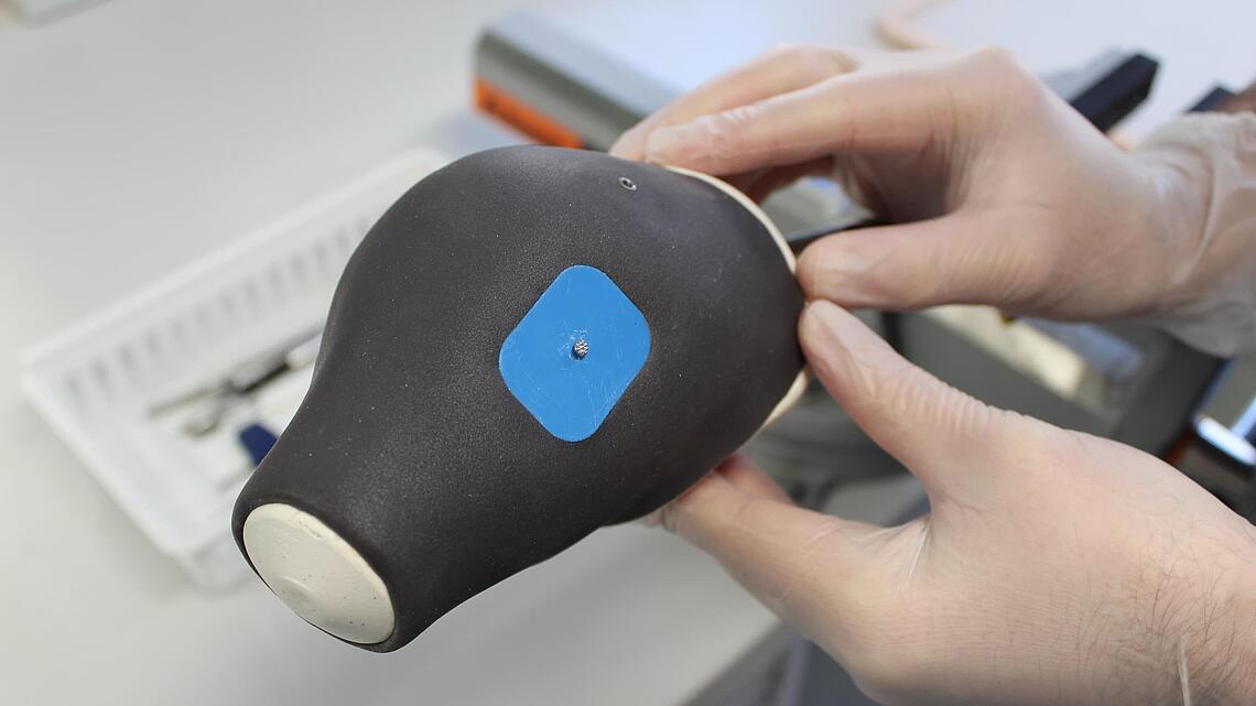 Silikon-Schaft für Unterarmprothese schwarz-blauer Silikon-Schaft für eine Unterarmprothese