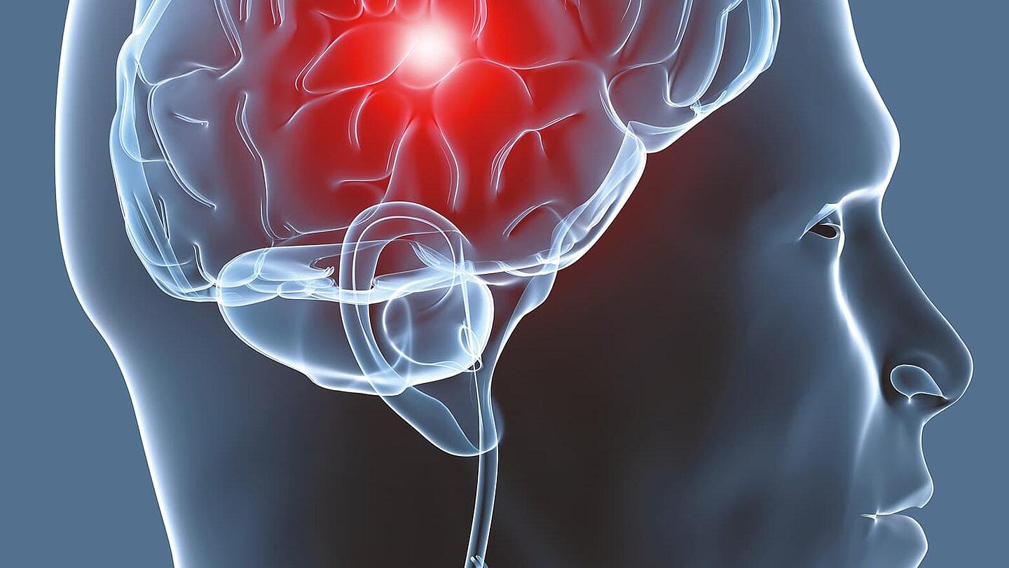 Schemabild von einem Kopf mit Gehirn, Bild: Ottobock Schemabild von einem Kopf mit Gehirn, in dem ein rot leuchtender Punkt zu sehen ist, Bild: Ottobock