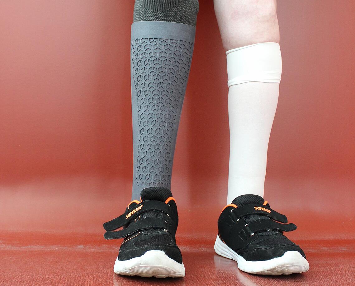 individuelles Cover einer Unterschenkel-Prothese graues, individuelles Cover einer Unterschenkel-Prothese aus dem 3D-Drucker