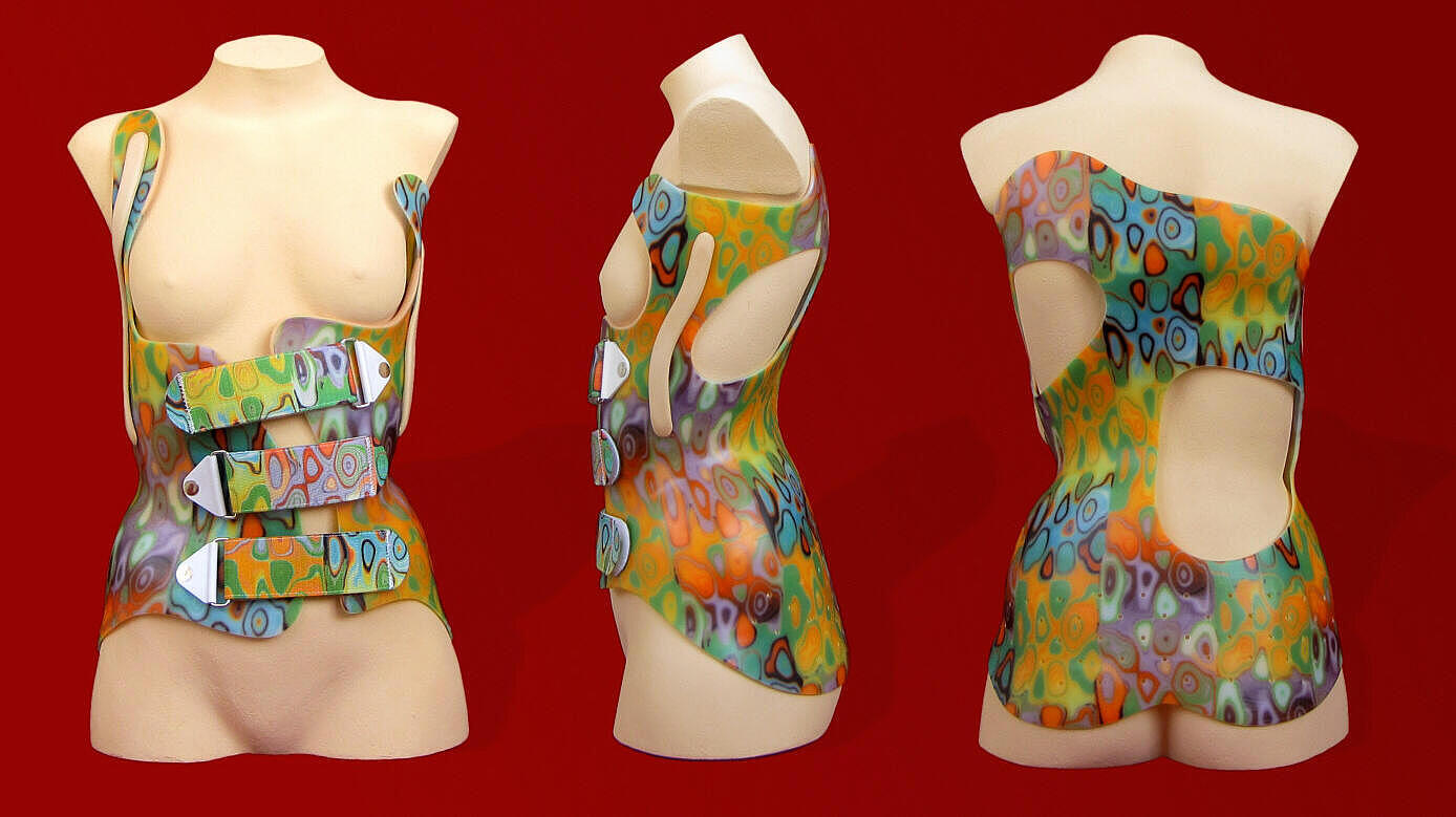 Ansichten einer Rumpforthese verschiedene Ansichten einer bunten Rumpforthese bei einer Skoliose