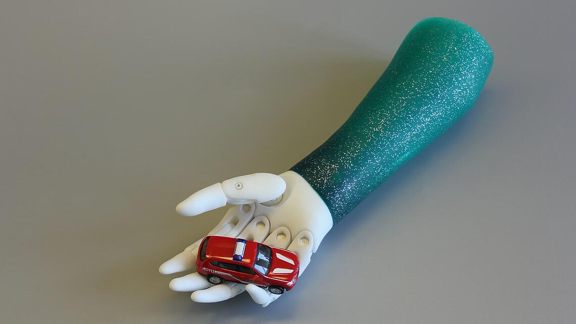 Unterarmprothese mit Glitzer-Silikon-Schaft Unterarmprothese mit türkisem Glitzer-Silikon-Schaft, der ein kleines Auto hält