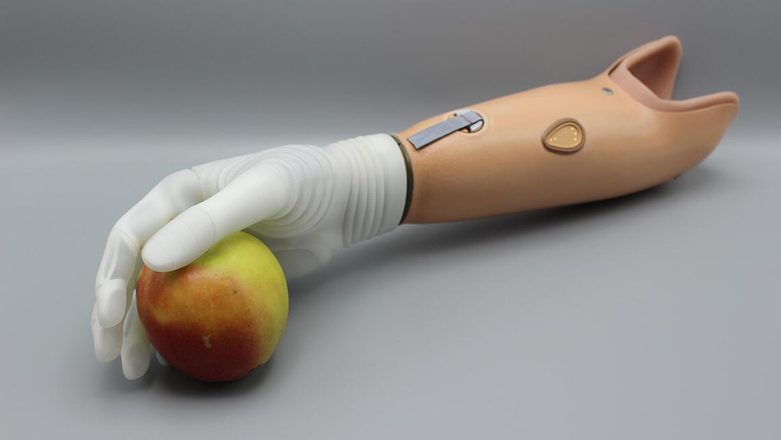 myoelektrische Armprothese mit Apfel myoelektrische Armprothese mit weißer Hand, die Apfel hält