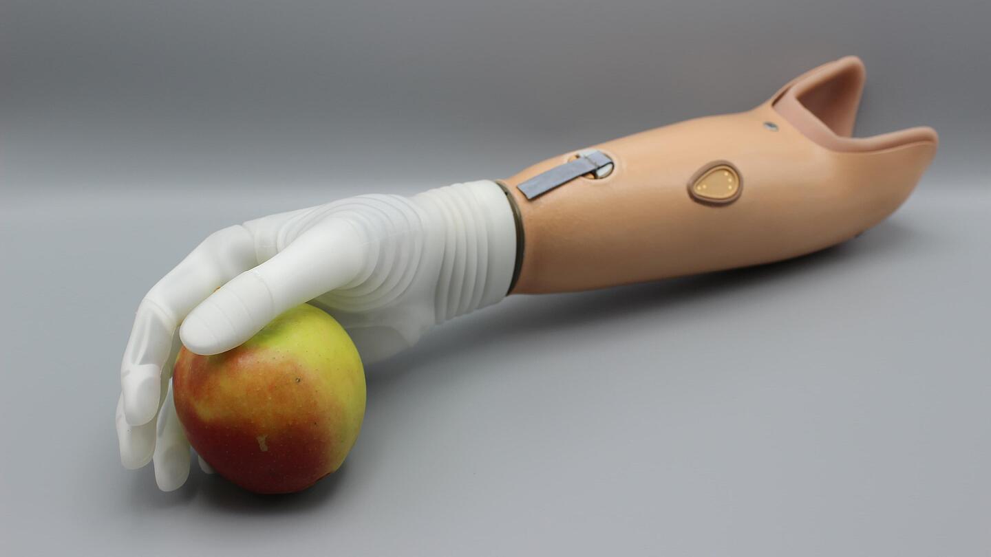myoelektrische Armprothese mit Apfel myoelektrische Armprothese mit weißer Hand, die Apfel hält