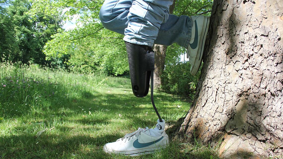 hochaktive Alltagsprothese mit Cheetah-Prothesenfuß am Baum gelehnt Träger einer Unterschenkel-Sportprothese mit Cheetah-Prothesenfuß lehnt am Baum