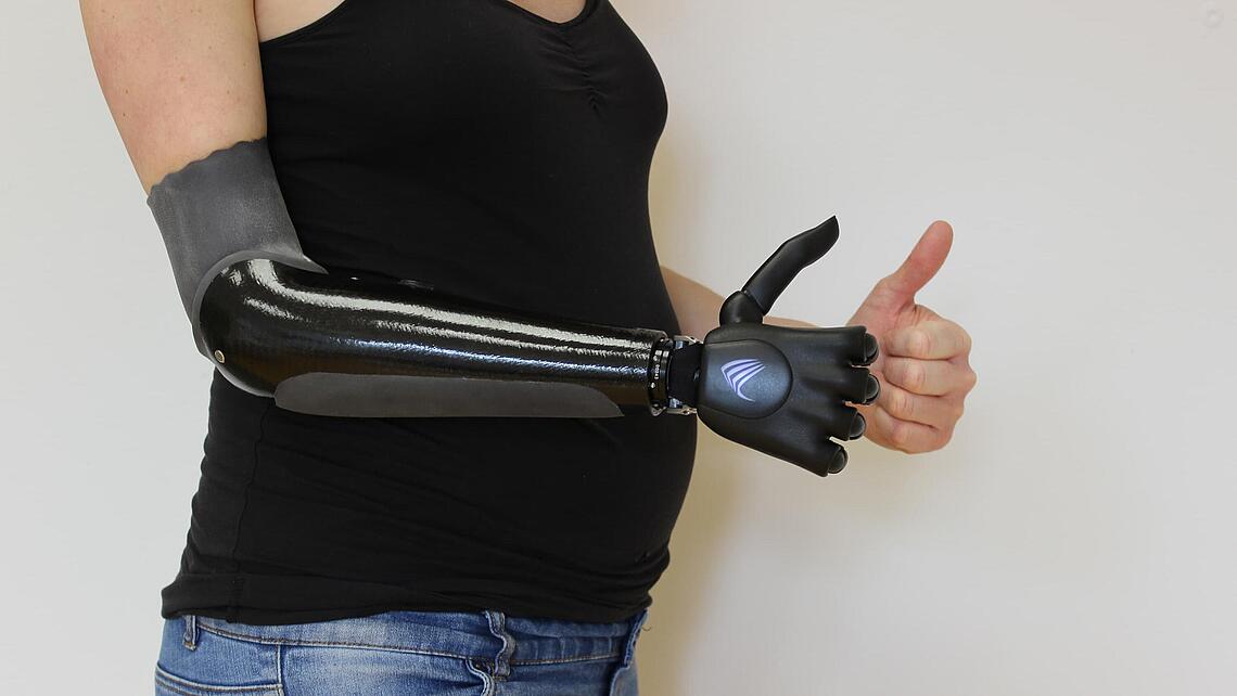 myoelektrische Handprothese Vincent Evolution 4 Daumen hoch mit einer myoelektrische Handprothese