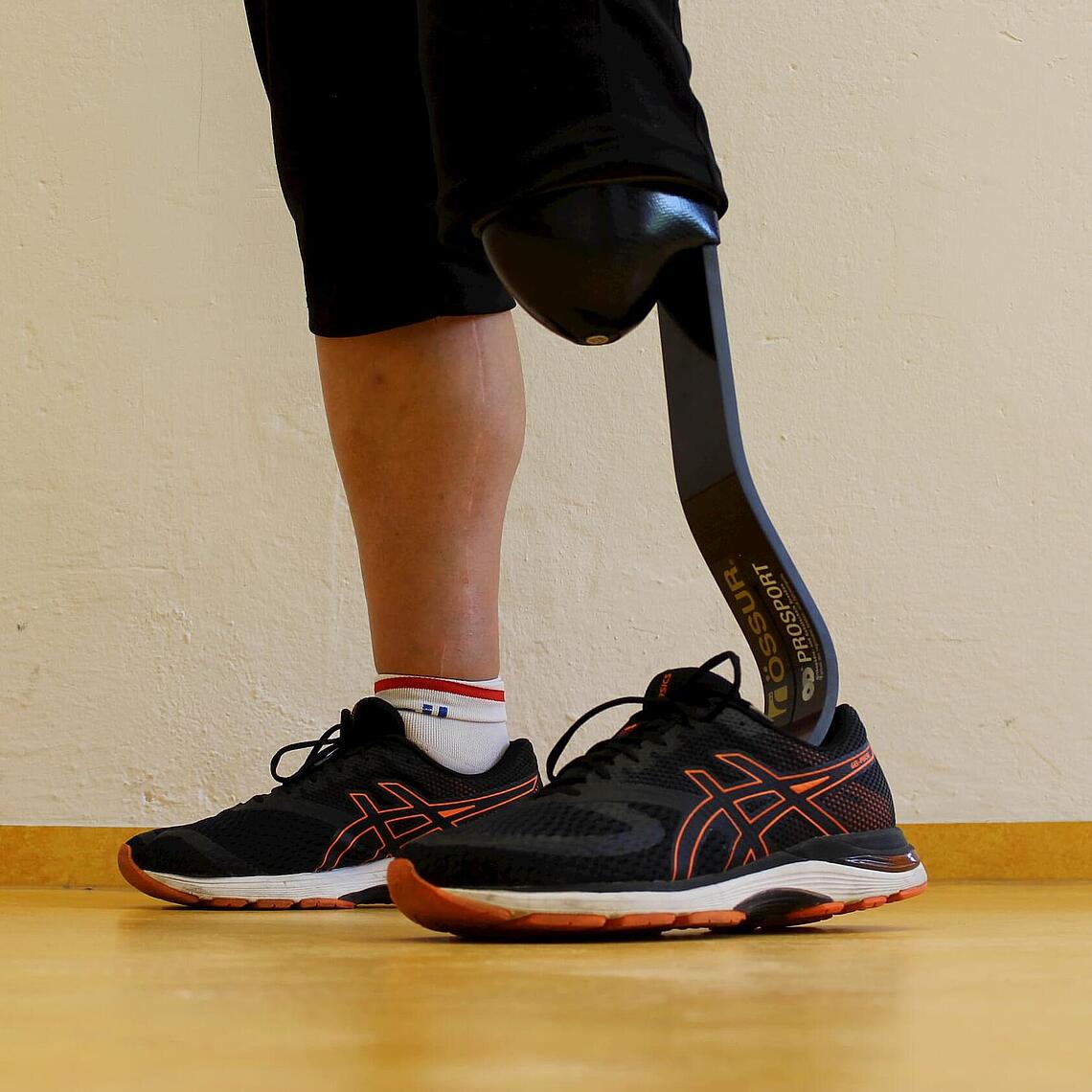 Unterschenkelprothese mit Cheetah X-plore Fuß ein natürliches Bein und eine Unterschenkel-Prothese als Feder im Turnschuh