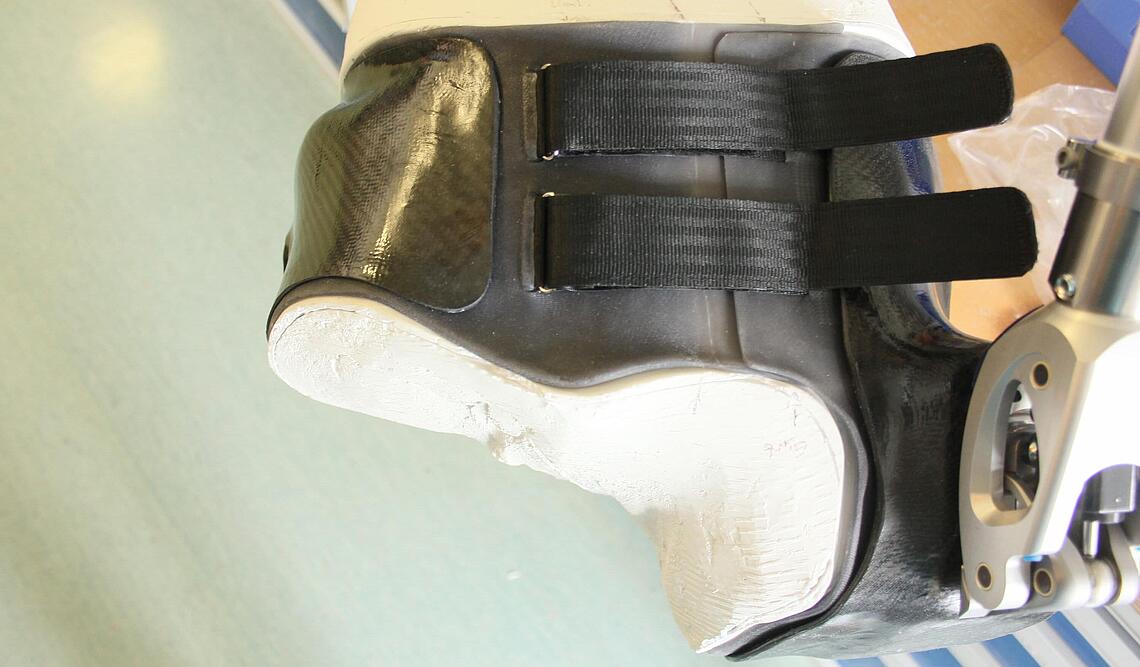 Silikon-Innenschaft für eine Hüftexartikulationprothese Innenschaft aus schwarzem Silikon für eine Hüftexartikulationprothese