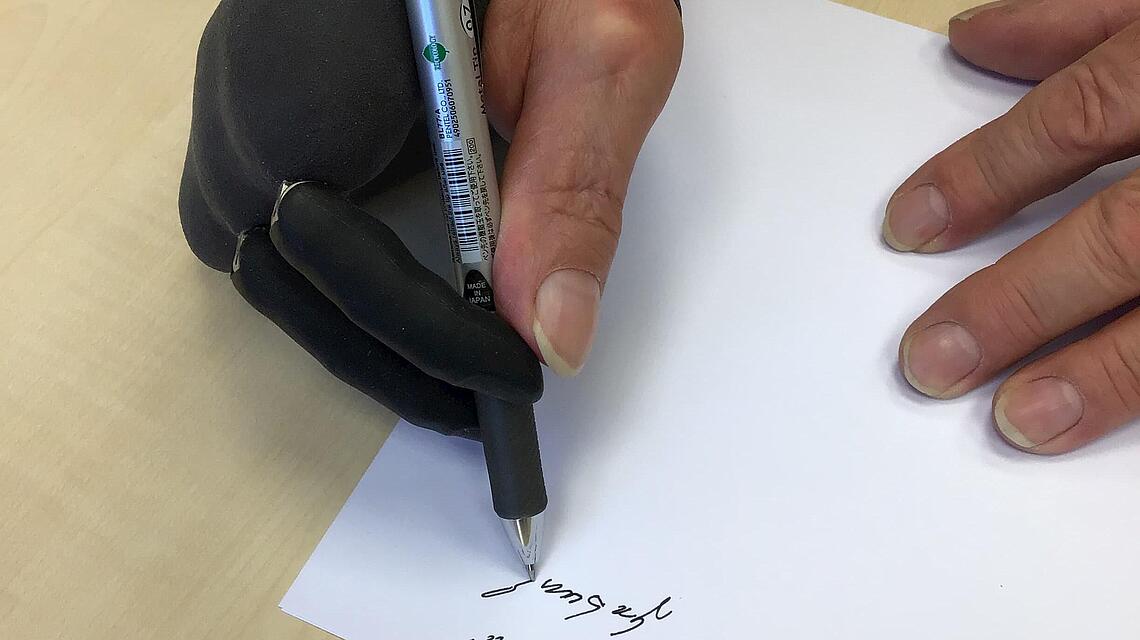Teilhandprothese mit der geschrieben wird Teilhandprothese, die einen Stift hält und mit der geschrieben wird