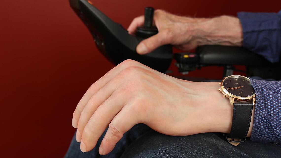 Unterarmprothese aus Silikon angezogene Unterarmprothese aus Silikon mit Armbanduhr